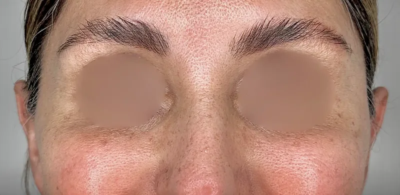After treatment