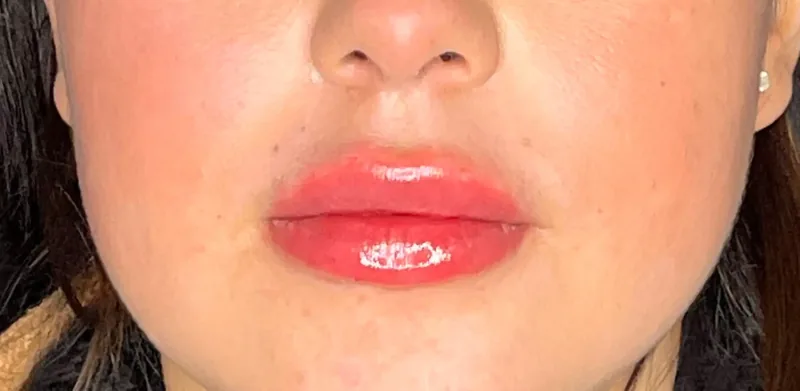 After treatment